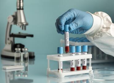 Mikrobiyoloji Testleri Nelerdir?